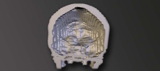 3dmodel of skull