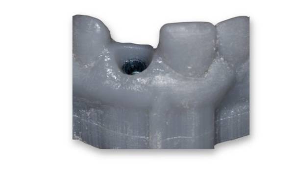 dental_5