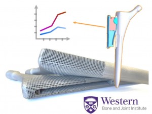 Renishaw 3d printed smart implant