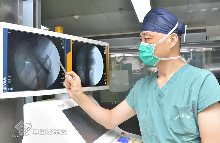 西京医院3D打印仿生钛合金股骨头支撑棒首次临床应用