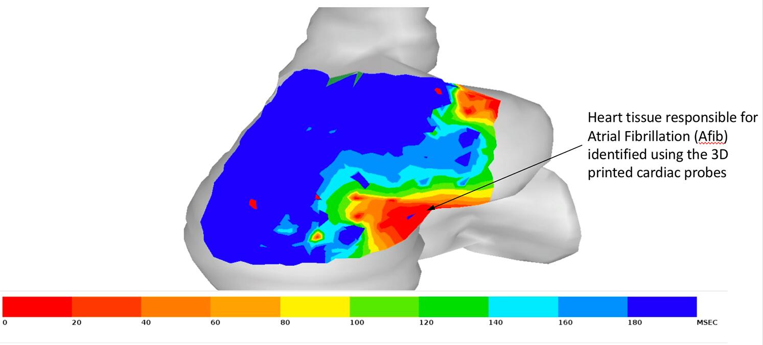 斯坦福大学用3D打印开发定制化心脏房颤治疗装置