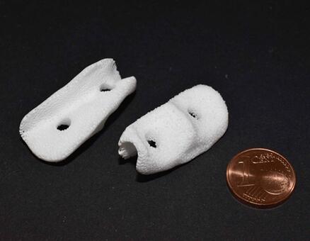 案例 l 高精度陶瓷3D打印在医疗行业的多种应用